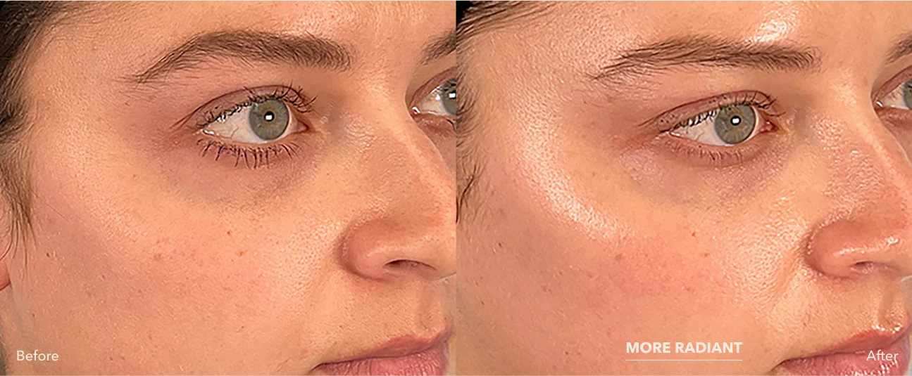 Before and after xomd1