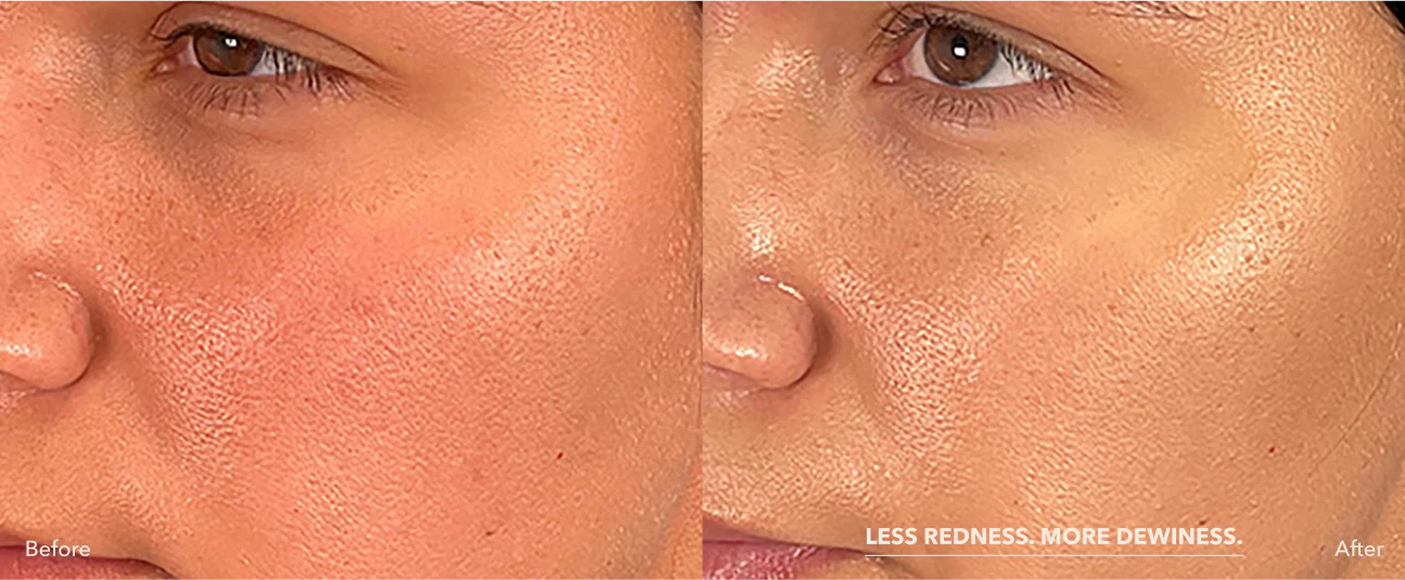 Before and after xomd3